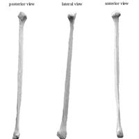 Human Fibula Bone